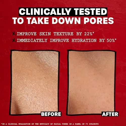 Another view of the THAYERS Alcohol-Free Rose Petal Witch Hazel Facial Toner for Glowing
