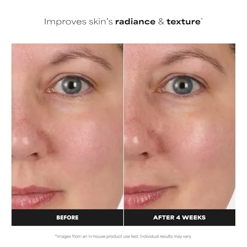 The Paula's Choice Niacinamide Face Toner, Combination or Oily Skin | in real use