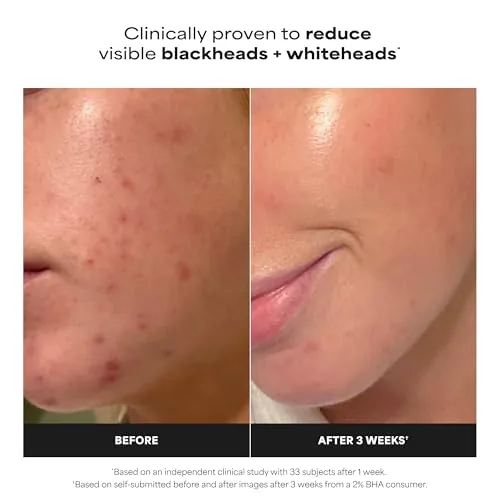 Close look at the Paula's Choice SKIN PERFECTING 2% BHA Liquid Exfoliant | Gentle build quality