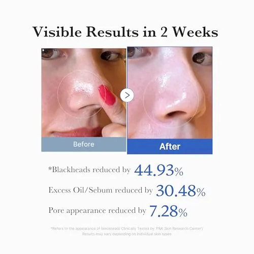 Another view of the medicube Toner Pads Zero Pore Pad 2.0 for Exfoliation and