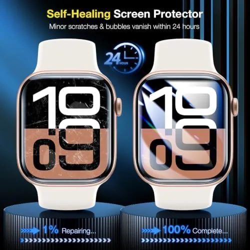 The LK 6 Pack for Apple Watch Series 11/ Series 10 compared in context