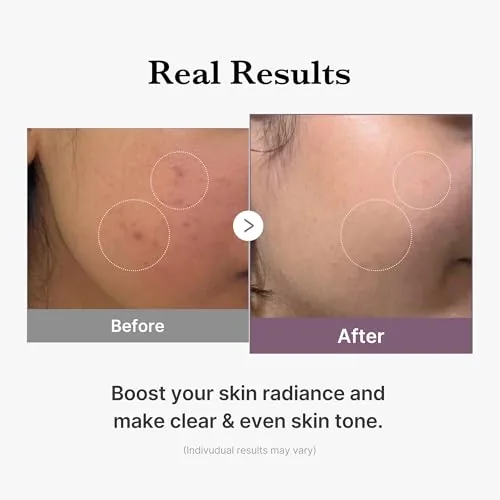 Another view of the medicube Age-R Glutathione Glow Milky Toner | Low-Irritation Double Layer
